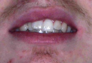 WS After