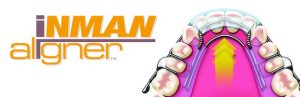Inman
